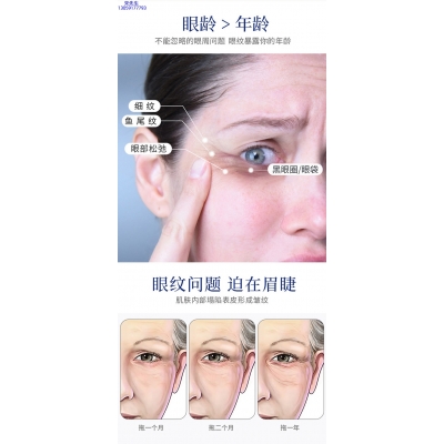 古泉_美容院玻尿酸微针眼贴